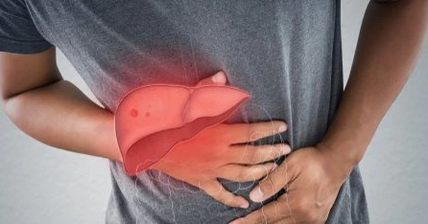 Thức Ăn Tốt Cho Người Men Gan Cao